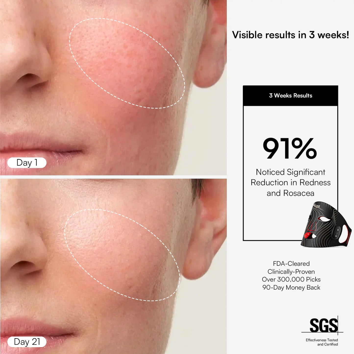 INIA Wireless Red Light Therapy Mask