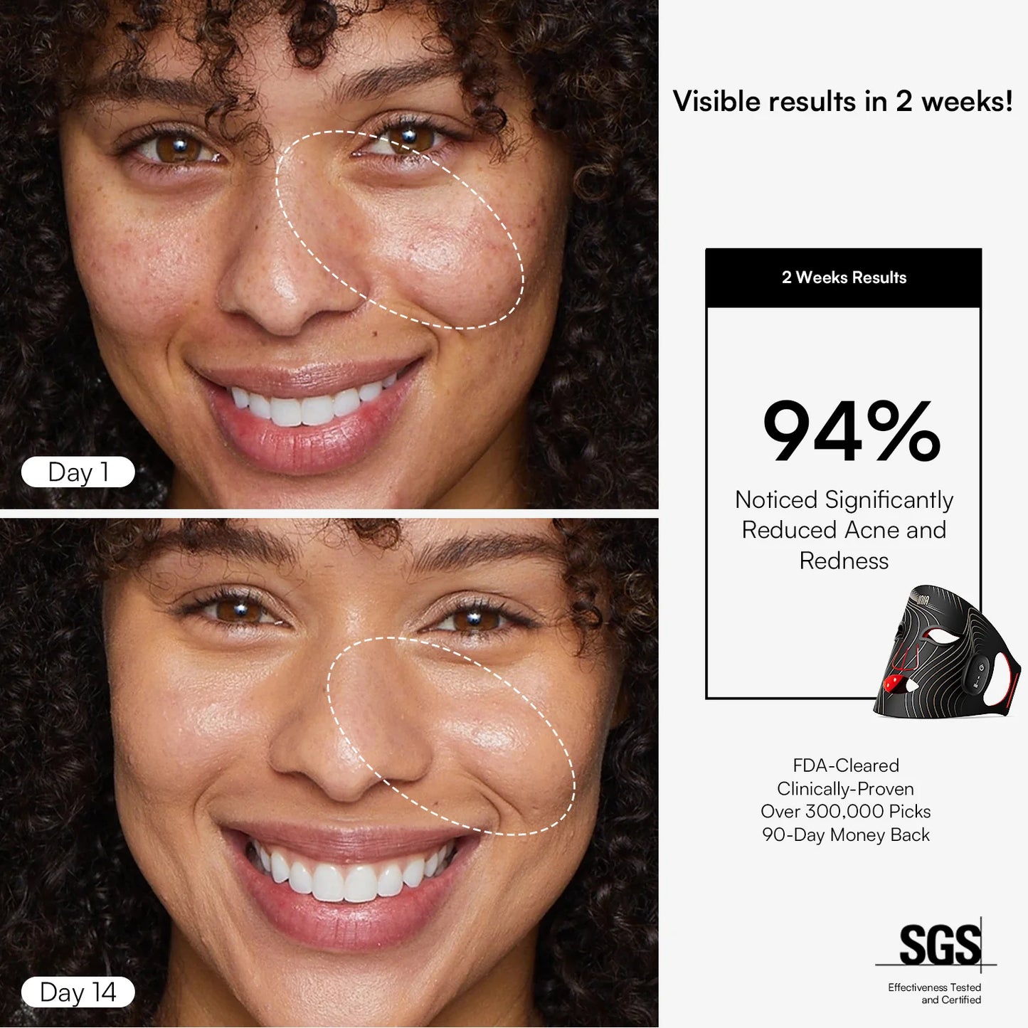 INIA  Wireless Red Light Therapy Mask